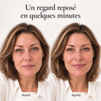 Patchs anti-cernes au PDRN